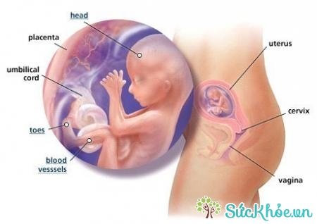 Nguyên nhân thai nhi bị suy dinh dưỡng do bệnh nhiễm trùng ở người mẹ