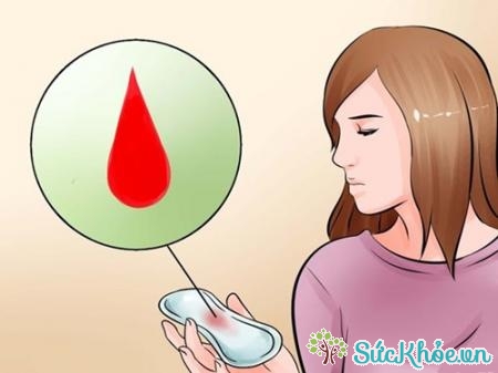 Chảy máu âm đạo là biểu hiện ung thư buồng trứng rõ nhất