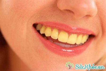 Tác dụng không mong muốn là răng có thể bị nhuộm vàng
