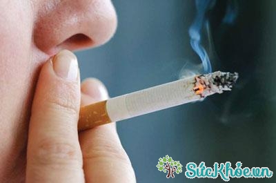 Hút thuốc lá có thể là nguyên nhân gây ung thư đầu cổ