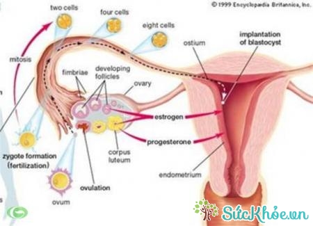 U quái buồng trứng là một trong những thể của u nang buồng trứng
