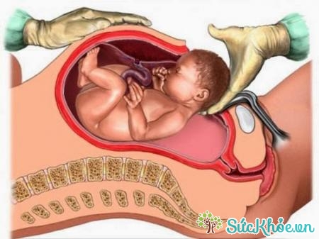 Tầng sinh môn có vai trò nuôi thai và sinh con