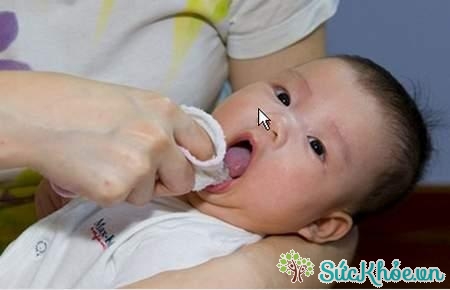 Cách chăm sóc trẻ mọc răng