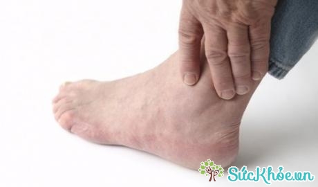 Thoái hóa khớp cổ chân có nguyên nhân chủ yếu là do tuổi tác