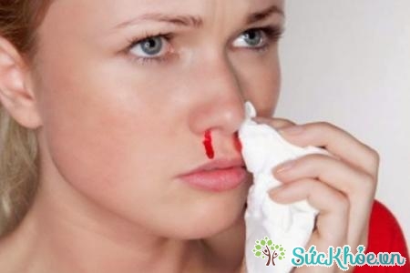 Chảy máu mũi là biểu hiện của nhiều bệnh