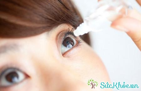 Biểu hiện của bệnh viêm bờ mi mắt