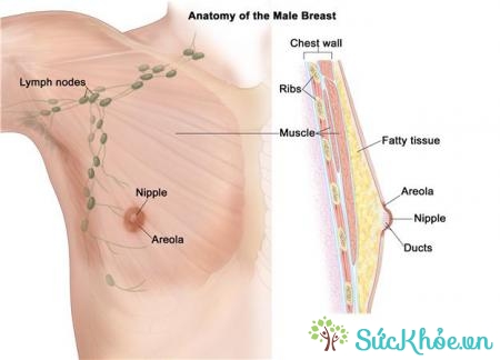 Bướu sợi tuyến thường bị nhầm với bệnh ung thư vú