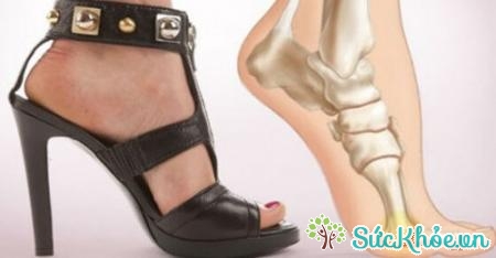 Tác hại khi đi giày cao gót ảnh hưởng trực tiếp tới sức khỏe của chị em