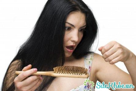 Một trong những dấu hiệu cơ thể thiếu sắt là rụng tóc