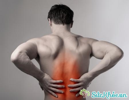 Đau cơ xơ hóa đặc trưng bởi đau cơ xương lan tỏa