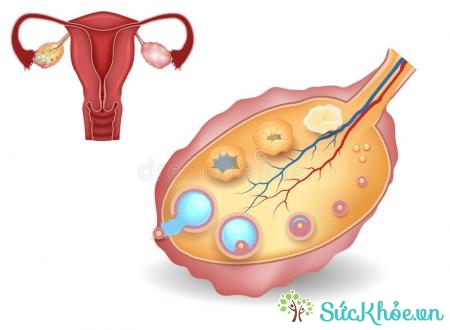 Hormone sinh dục nữ bắt nguồn từ tuyến sinh dục nữ giới