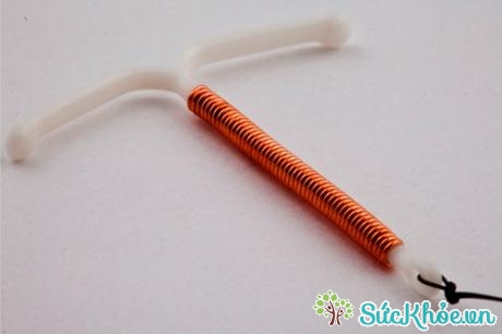 Vòng tránh thai là một dụng cụ nhỏ bằng nhựa được đặt vào tử cung.