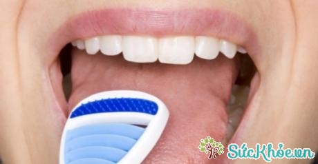 Lười vệ sinh lưỡi có thể dẫn tới những bệnh về răng miệng