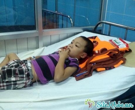 Em bé 5 tuổi ở Quảng Bình đã phải nhập viện vì bị đàn ong đốt 20 nốt (Ảnh: Vnexpress)