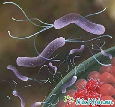 Vi khuẩn Helicobacter pylori gây loét dạ dày