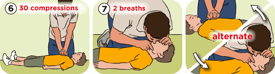 Nếu nạn nhân có dấu hiệu ngưng thở thì cần hà hơi thổi ngạt