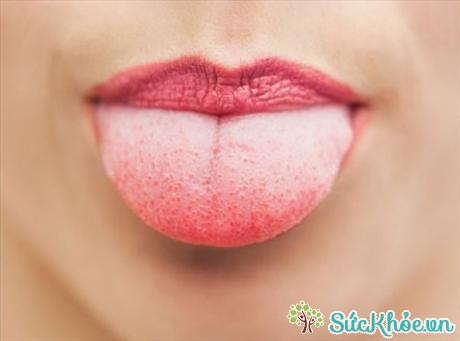 Lưỡi người bình thường sẽ có màu hồng, không quá khô hay quá ướt (ảnh: internet)