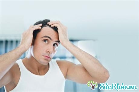 Hói đầu ở nam giới có xu hướng do di truyền