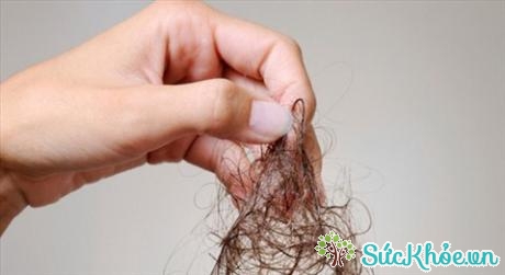 Nếu bạn gội đầu mỗi ngày thì tình trạng rụng tóc có thể trầm trọng thêm