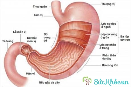 Trên 90% trong viêm loét dạ dày trong đó có bờ cong nhỏ là do vi khuẩn Helicobacter pylori