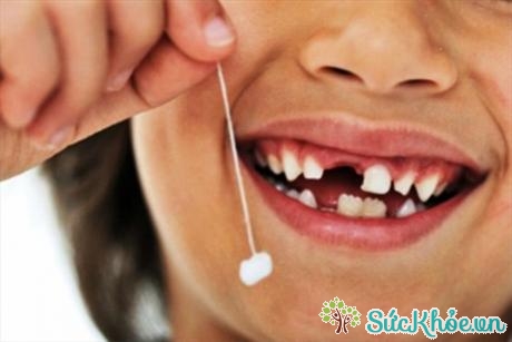 Nhổ răng sữa khi mới bắt đầu lung lay có nguy cơ phá vỡ cấu trúc răng của trẻ