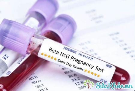 Xét nghiệm HCG để biết xem bạn đã mang thai hay chưa
