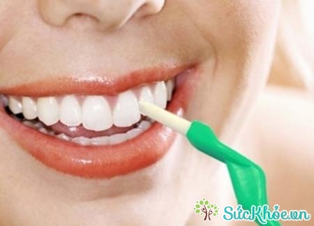 Quá trình cần loại bỏ vôi răng là cạo vôi răng