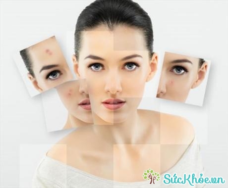 Viêm da và triệu chứng khi bạn sử dụng mỹ phẩm sẽ khiến cho da mặt bị sưng tấy