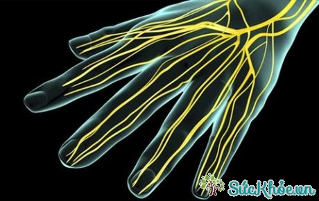 Một trong những nguyên nhân thường gặp nhất của tình trạng tệ bại tay là hội chứng ống cổ tay