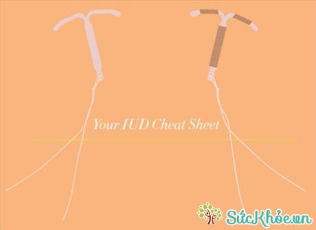 IUD là một dụng cụ nhỏ, hình chữ T được bác sĩ đặt trong tử cung của người phụ nữ để ngừa thai.