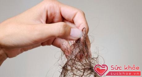 Nếu bạn đang đau đầu vì tóc rụng nhiều thì tốt nhất nên hạn chế tần suất gội đầu lại
