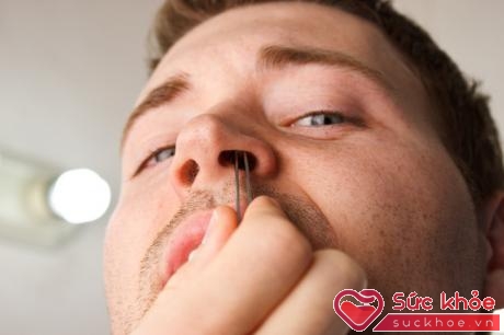 Nhổ lông mũi có thể gây tổn thương niêm mạc mũi.