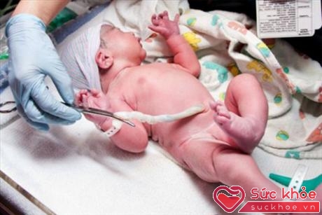 Có thể thực hiện lưu trữ tế bào gốc máu cuống rốn ngay sau sinh cho con.