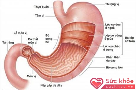 Trên 90% trong viêm loét dạ dày trong đó có bờ cong nhỏ là do vi khuẩn Helicobacter pylori