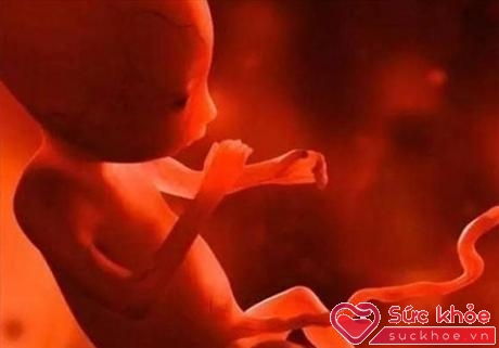 Hiện tượng bào thai trong bào thai hay thai nhi ký sinh là một trong những bệnh lý rất hiếm gặp.