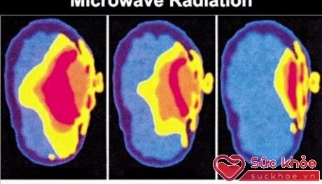 Nhiều nghiên cứu cũng đã tiết lộ việc bức xạ của ĐTDĐ có thể gây ung thư