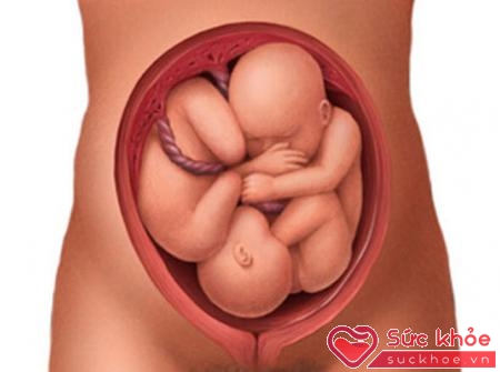 Ngôi thai là phần trình diện trong khung xương chậu của mẹ và ra ngoài đầu tiên