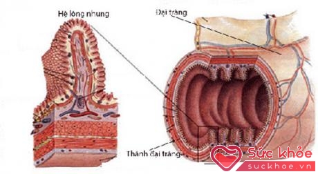 Hệ lông nhung trong thành đại tràng là nơi cư trú của lợi khuẩn