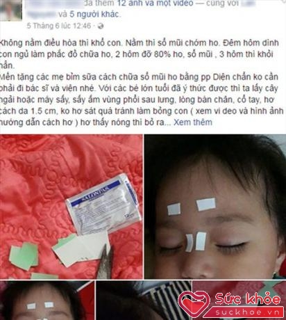 Phương pháp 'diện chẩn' chữa ho và sổ mũi cho trẻ nhỏ được người dùng facebook có tên T.V.A hướng dẫn.