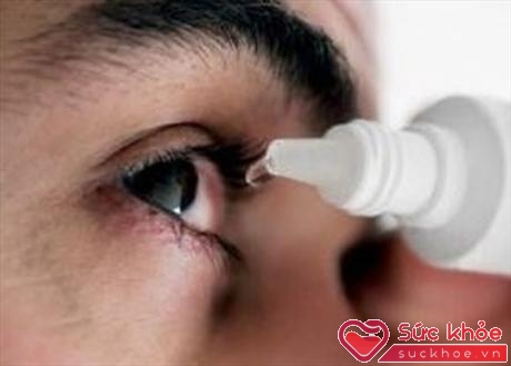 Người bị đau mắt đỏ cần phải rửa và vệ sinh mắt thật sạch trước khi nhỏ mắt (Ảnh minh họa: Internet)