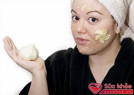 Trị mụn bằng tỏi có thể khiến da bạn bị bỏng (Ảnh minh họa: Internet)