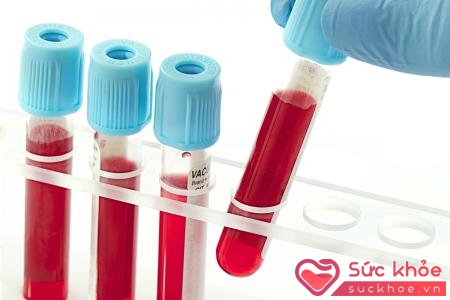 Xét nghiệm máu giúp chẩn đoán nhiều bệnh như tiểu đường, HIV...