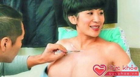 Bơm ngực là lựa chọn của nhiều phụ nữ nhưng hãy cẩn thận hoại tử ngực