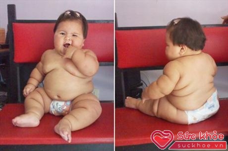 Bé gái Juanita Valentina Hernadez (Colombia) mới 10 tháng tuổi mà đã nặng 20 kg như bé 5 tuổi