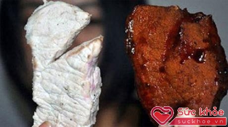 Thịt bẩn vào cơ thể tạo điều kiện cho kí sinh trùng làm ổ 