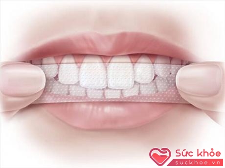 Theo như lời quảng cáo của nhiều chị em để làm trắng răng, chỉ cần dùng miếng dán làm trắng răng không cần phải mài răng nhiều như bọc răng sứ.