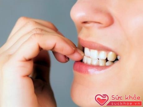 Theo Bác sĩ chuyên khoa Răn Hàm Mặt Nguyễn Vũ Trung hiện nay thì có nhiều phương pháp tẩy trắng răng.