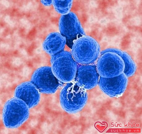 Streptoccocus pneumonia - Vi khuẩn thường gặp nhất trong VPCĐ.