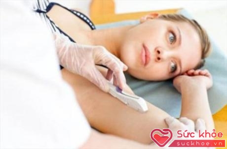 Phương pháp cấy que dưới da đã trở nên khá phổ biến và được nhiều người lựa chọn để tránh thai