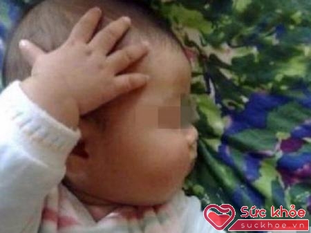 Mãi 2 tuần sau, người mẹ mới nghi ngờ về dấu hiệu này của con và đưa đi khám bác sĩ.